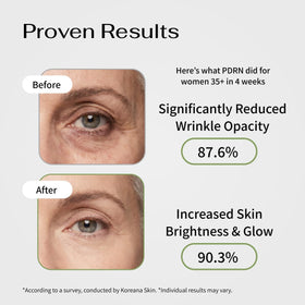 Koreana Skin gel texture detail showing hydrating serum shine