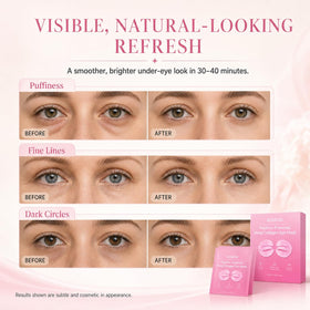 KOSEON model wearing patches under eyes showing comfortable secure fit benefit