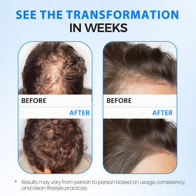 KPEBN thuja extract bottle close-up highlighting scalp conditioning benefit