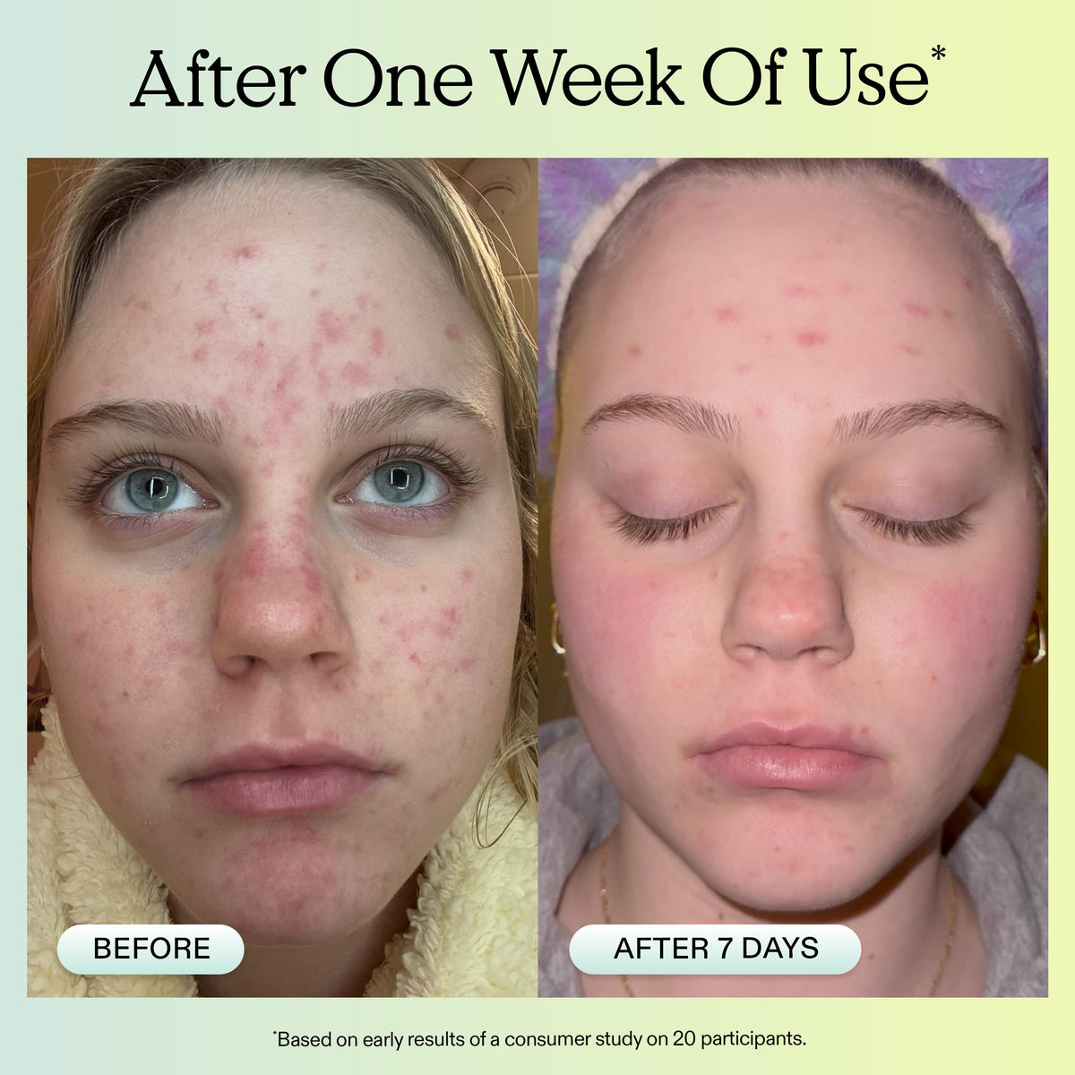 KraveBeauty Oil La La texture droplet on skin demonstrating fast absorption benefit