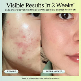 KraveBeauty applying serum to hand to show non-greasy hydration