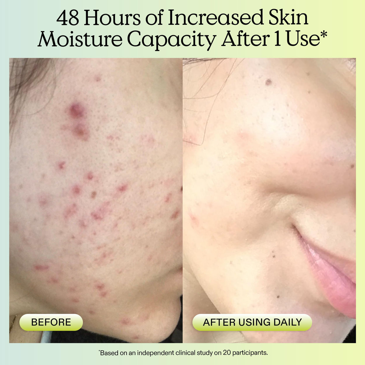 KraveBeauty gel texture close-up showing lightweight hydrating benefit