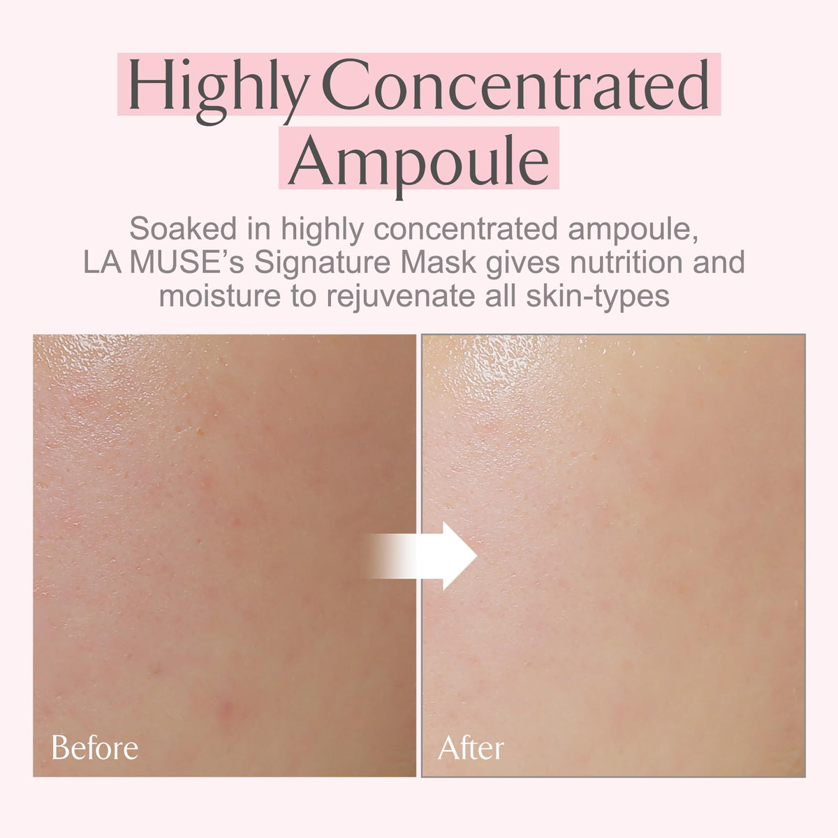 LA MUSE mask beside hand for scale to show full-face coverage