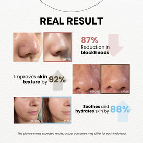La Noubelle before and after pore focus showing clearer, refined skin texture