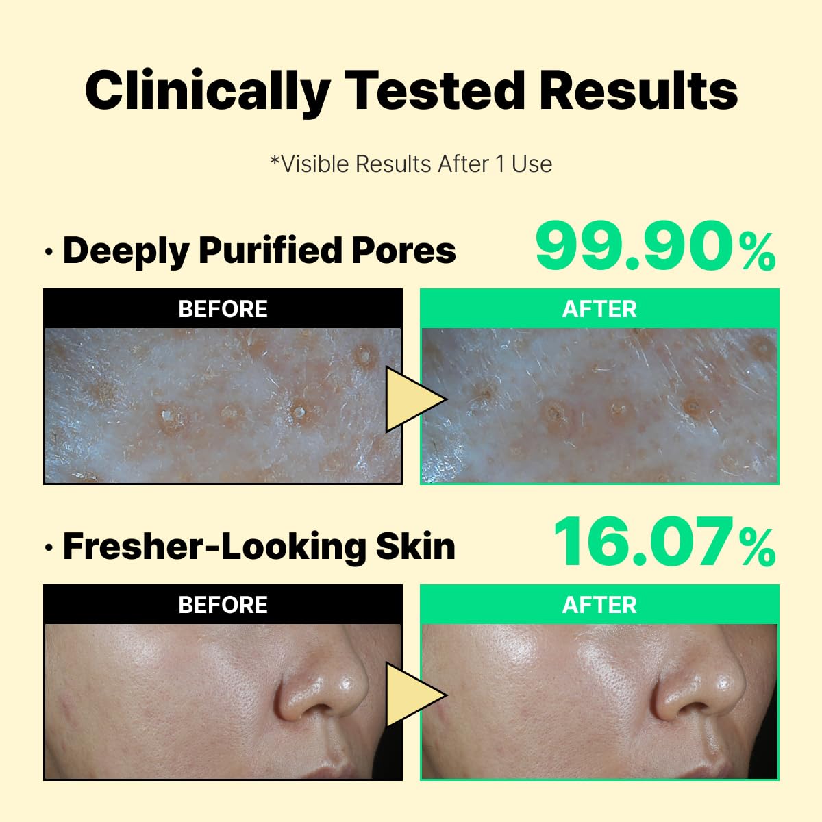 LABIORA mask applied on hand demonstrating easy 5-minute use