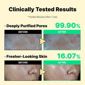 LABIORA mask applied on hand demonstrating easy 5-minute use