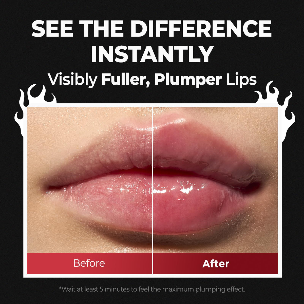 Laka lips before and after demonstrating fuller, plumper result