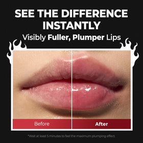 Laka lips before and after demonstrating fuller, plumper result