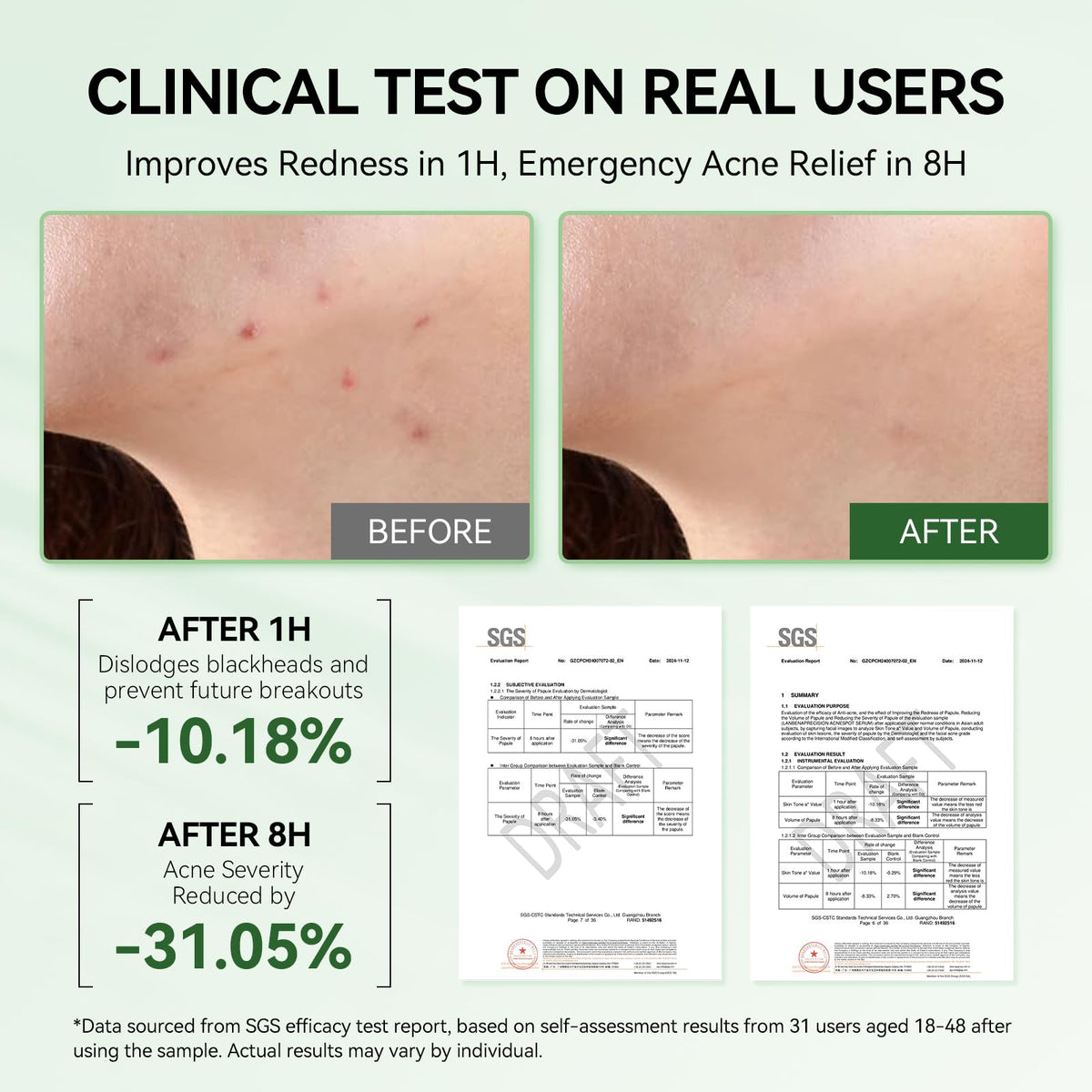 LANBENA clear serum dot on skin showing lightweight, non-sticky texture