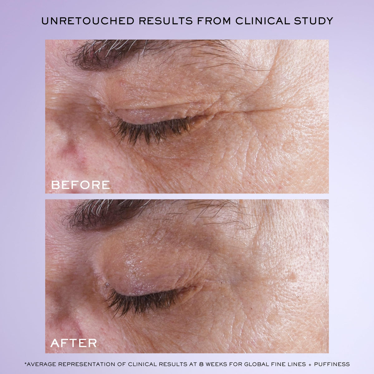 Lancôme applicator dispensing precise serum dose for easy under-eye application