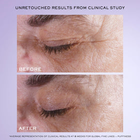 Lancôme applicator dispensing precise serum dose for easy under-eye application