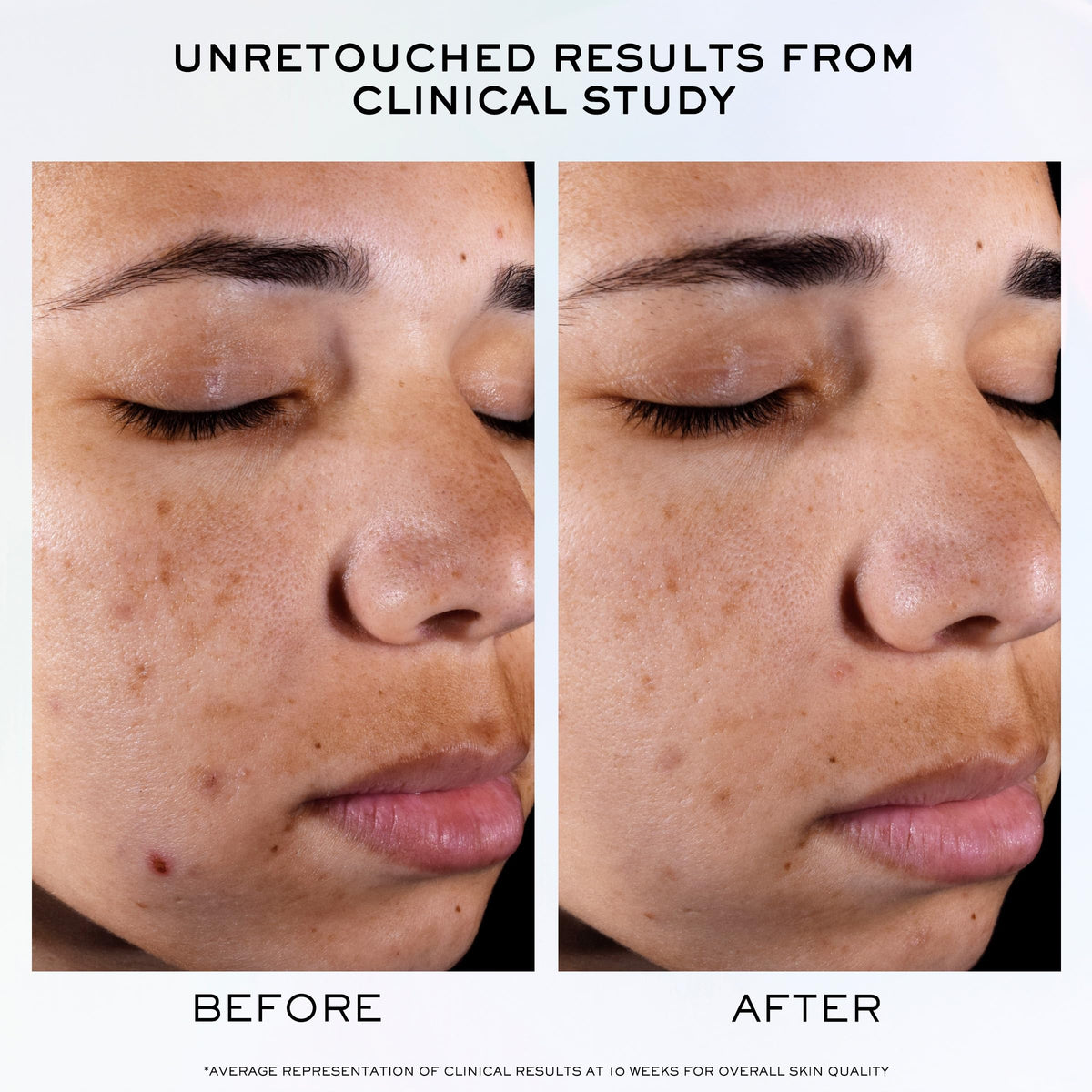 Lancôme Clarifique duo displayed side by side for size and scale comparison benefit