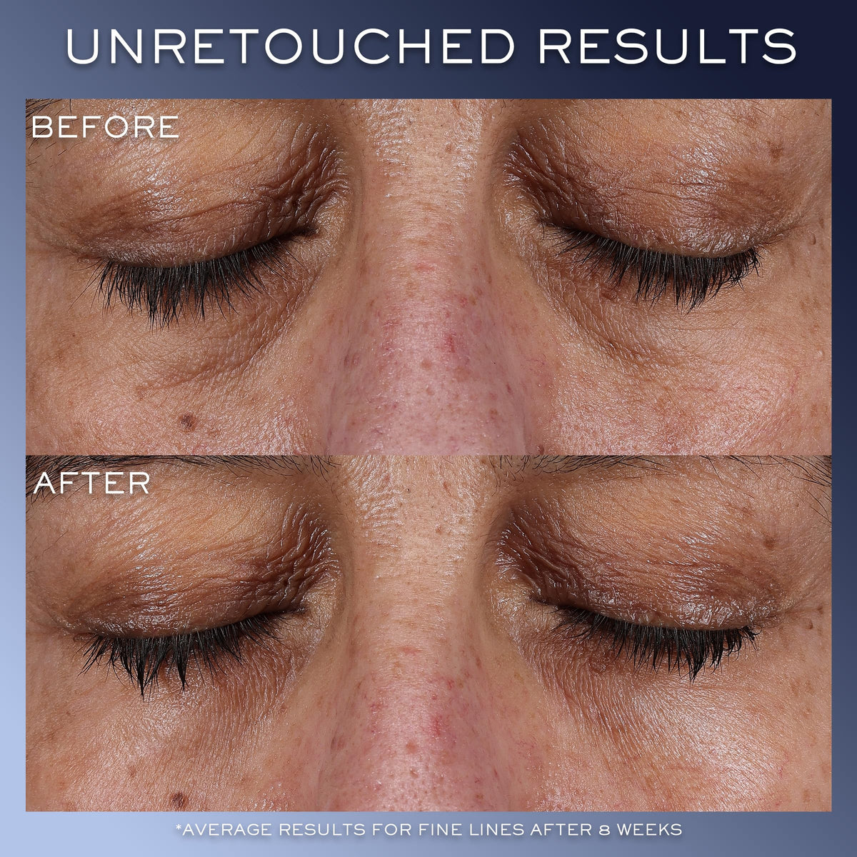 Lancôme applicator close-up demonstrating precise application and hygienic touch