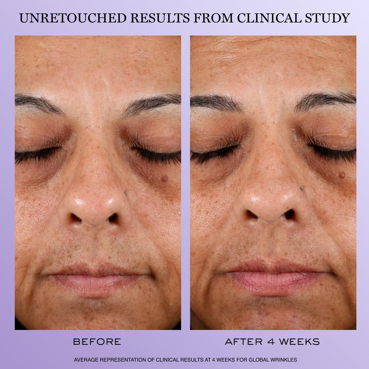 Lancôme refill mechanism close-up showing sustainable refill detail and ease benefit