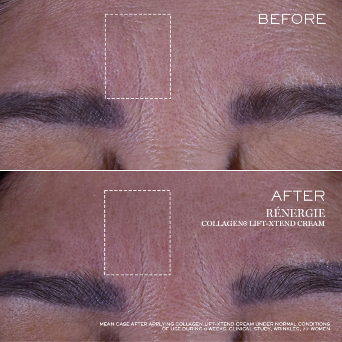 Lancôme illustrative before-and-after depiction showing improved cheek lift and firmer appearance