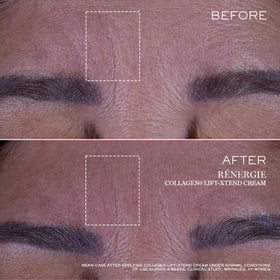 Lancôme illustrative before-and-after depiction showing improved cheek lift and firmer appearance