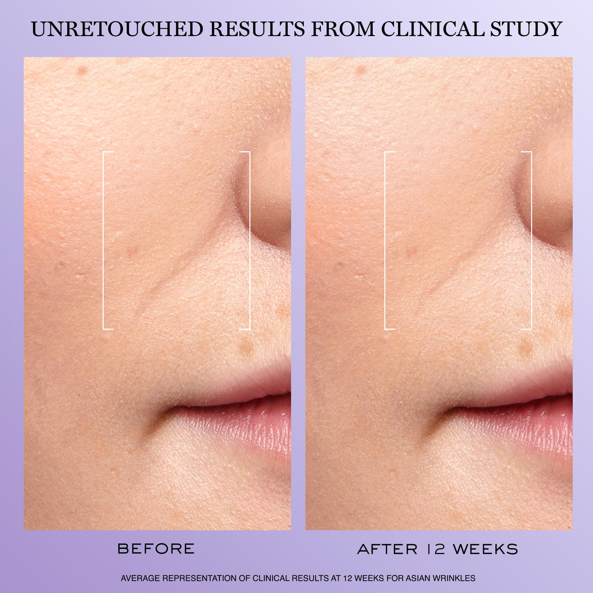 Lancôme serum texture drops on skin, shows hydrating lightweight feel