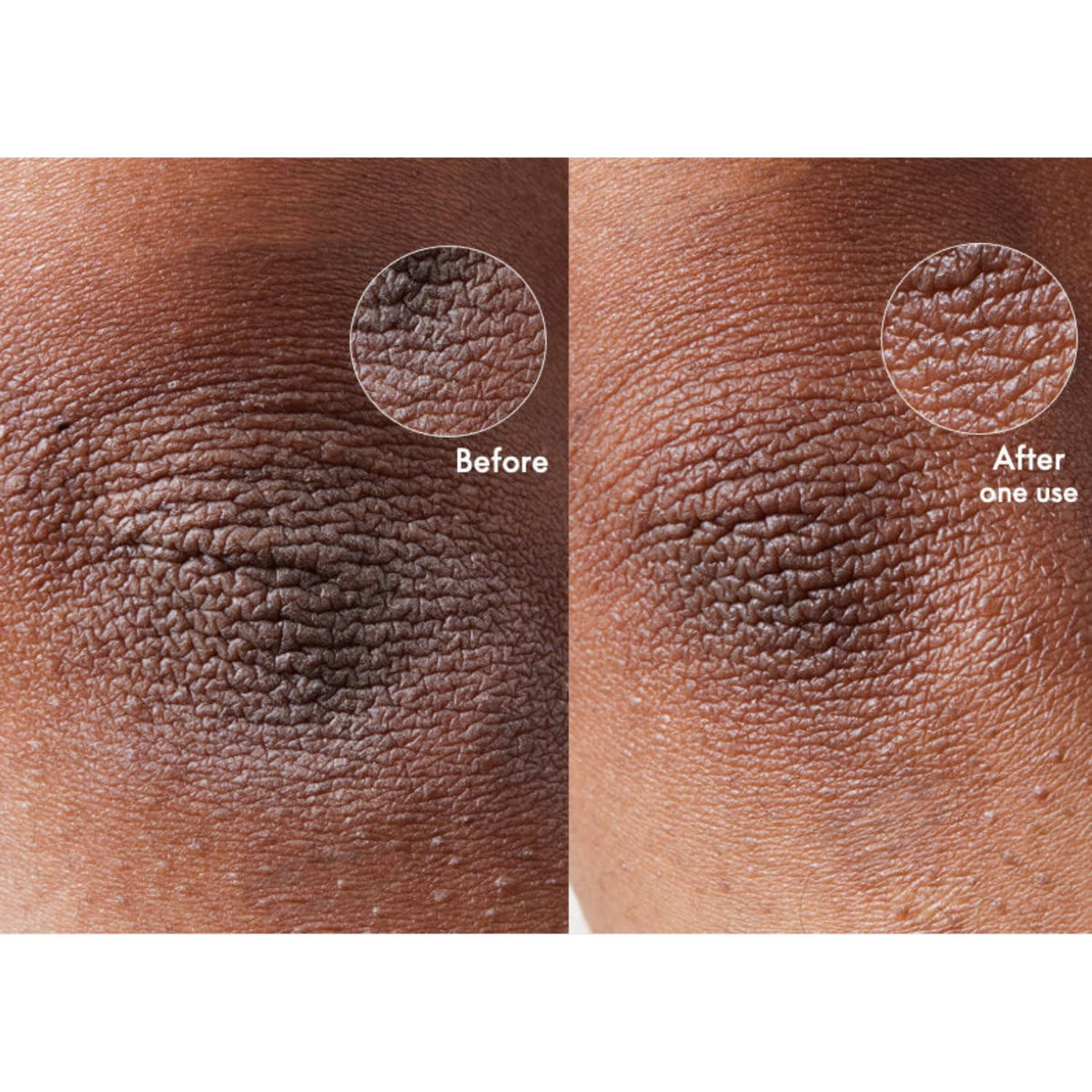 Applying Lanolips on hands to instantly soothe dryness and lock moisture