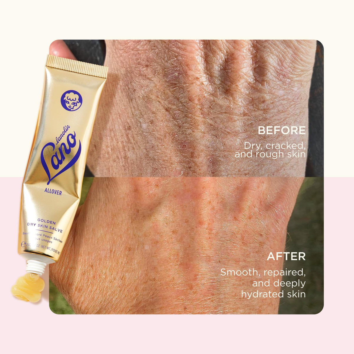 lanolips thick layer on heel showing intensive overnight repair