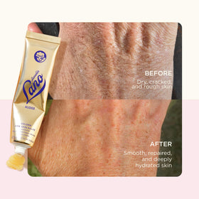 lanolips thick layer on heel showing intensive overnight repair