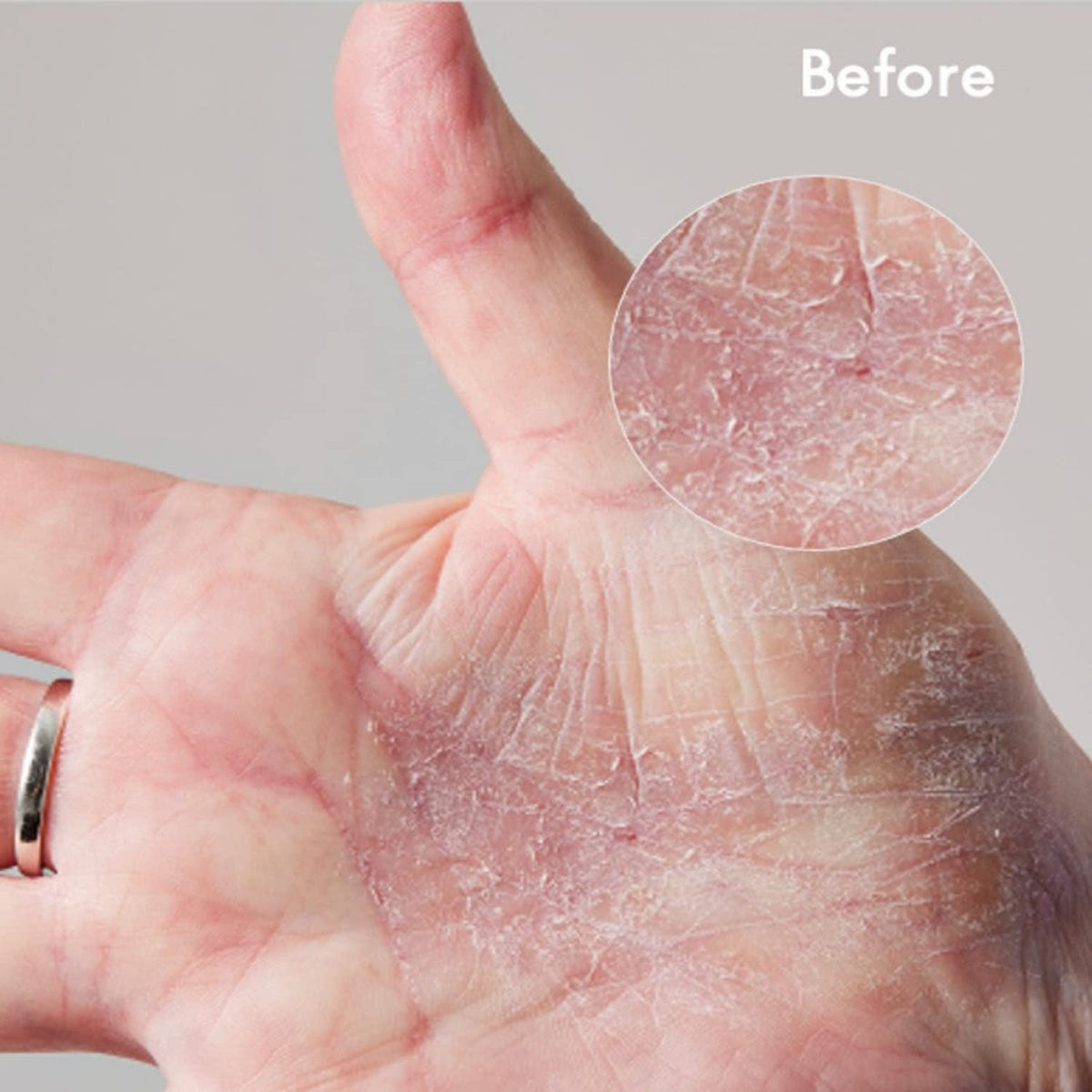 Lanolips opened jar revealing whipped interior for targeted travel use