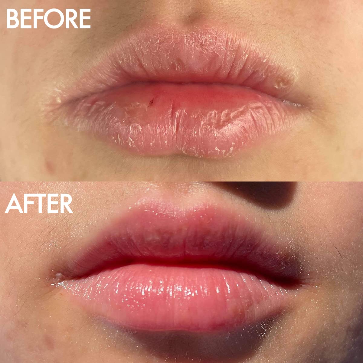 Lanolips ointment being applied to lips for instant soothing and shine