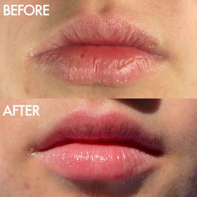 Lanolips ointment being applied to lips for instant soothing and shine