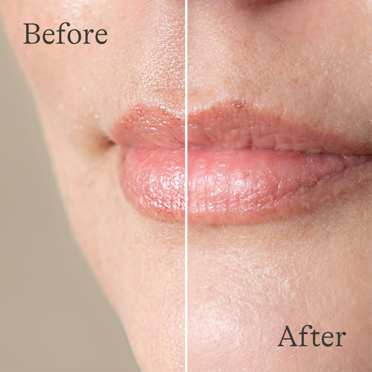 Lansinoh lip balm used outdoors to protect lips from wind and cold