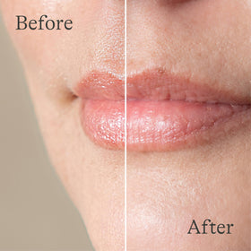 Lansinoh lip balm used outdoors to protect lips from wind and cold