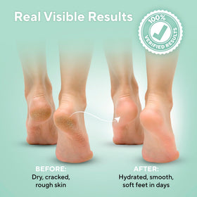 Lavinso being applied to hand showing ease of use and fast-absorbing hydration
