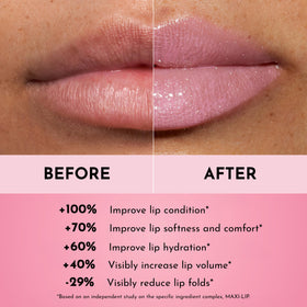 LAWLESS before and after lips demonstrating smoother, fuller-looking results