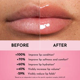 Lawless side profile lips before and after to highlight smoothing and plumping effect