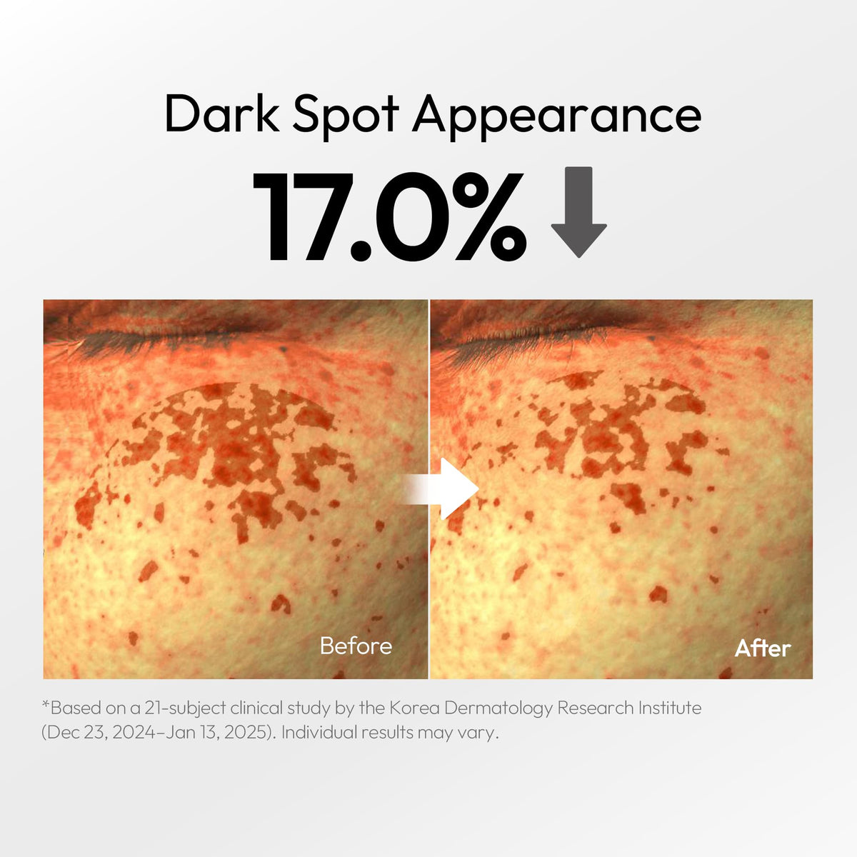 LAYERLAB ingredient label highlighting niacinamide and tranexamic acid for targeted tone care