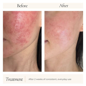 Le Mieux IsoCell in clinic aftercare setting showing professional use benefit