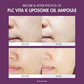 leegeehaam Dr.Ceuracle open dropper with serum texture, demonstrates lightweight absorbent texture