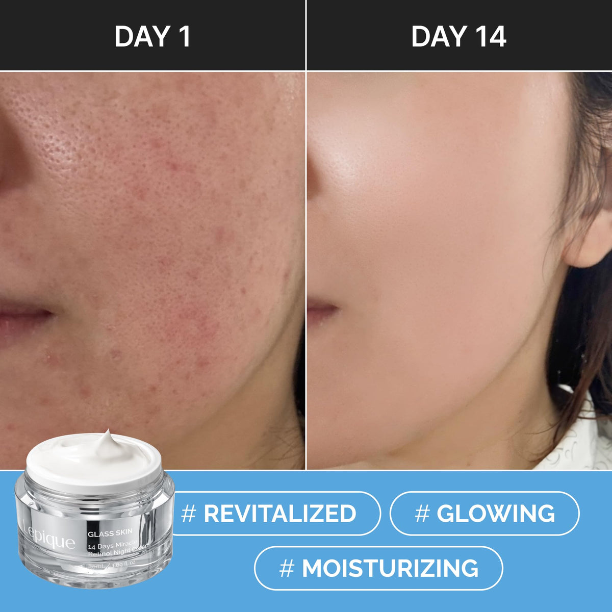 Lepique applying cream on hand demonstrating easy absorption benefit