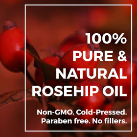 Leven Rose bottle with rosehip seeds and leaves showing natural origin benefit