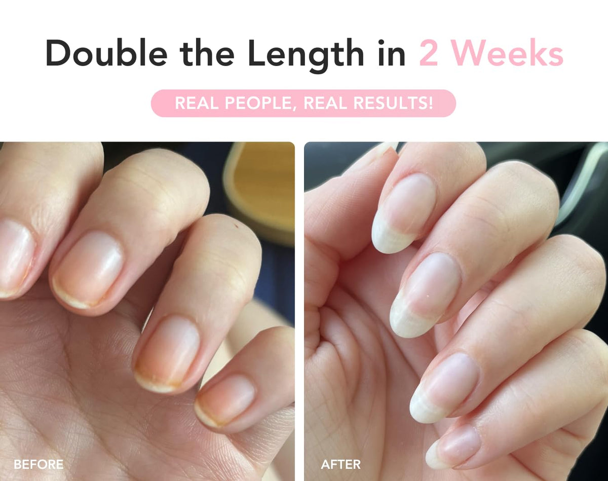 Liaison nail in use application showing targeted cuticle and nail coverage benefit