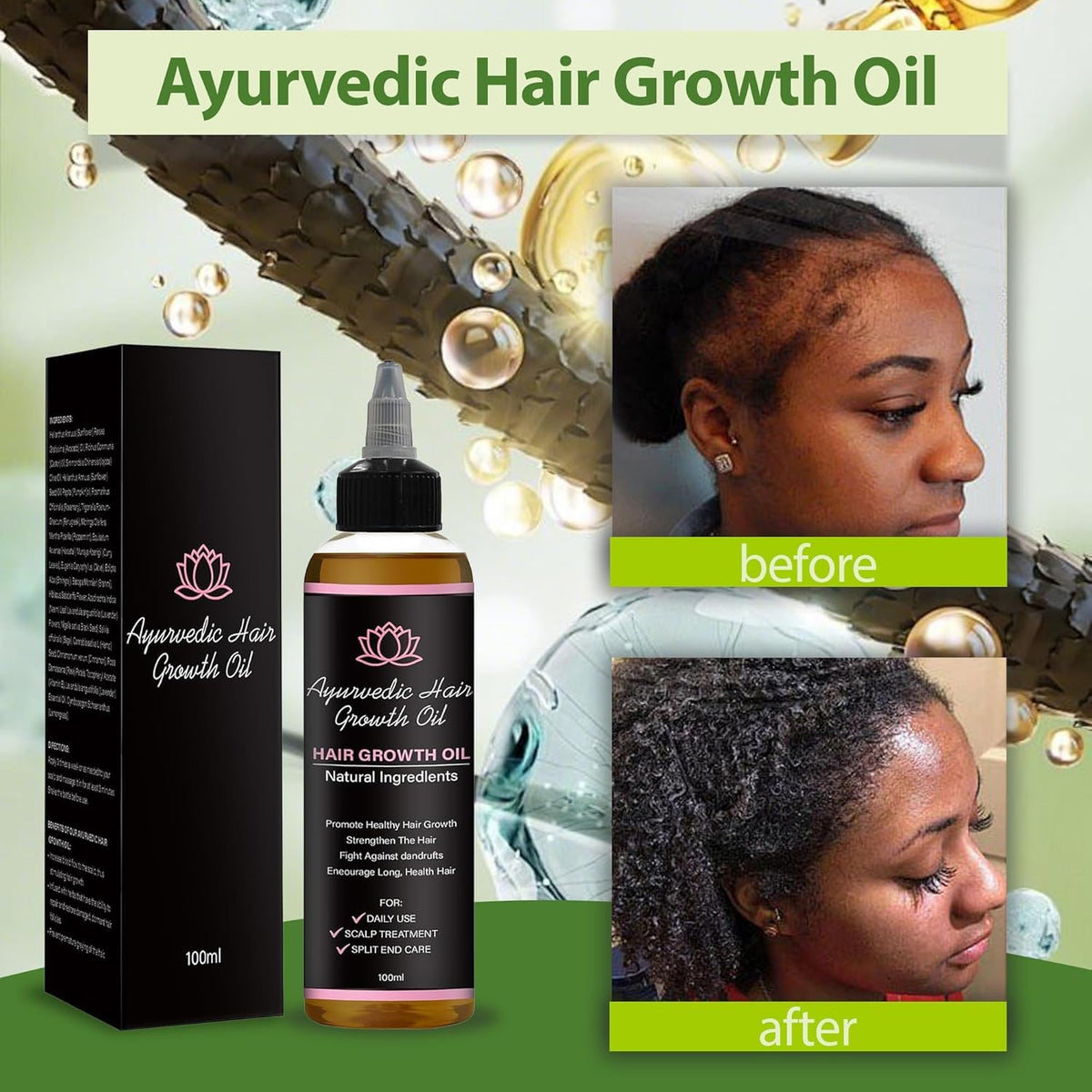 Lifewithqueenp oil texture droplet on skin demonstrating lightweight, non-greasy absorption