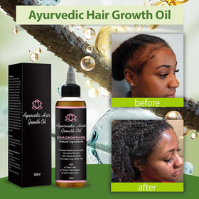 Lifewithqueenp oil texture droplet on skin demonstrating lightweight, non-greasy absorption