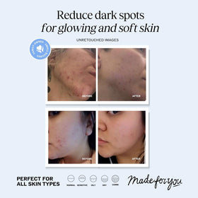LilyAna Naturals serum droplet on skin highlighting quick absorption