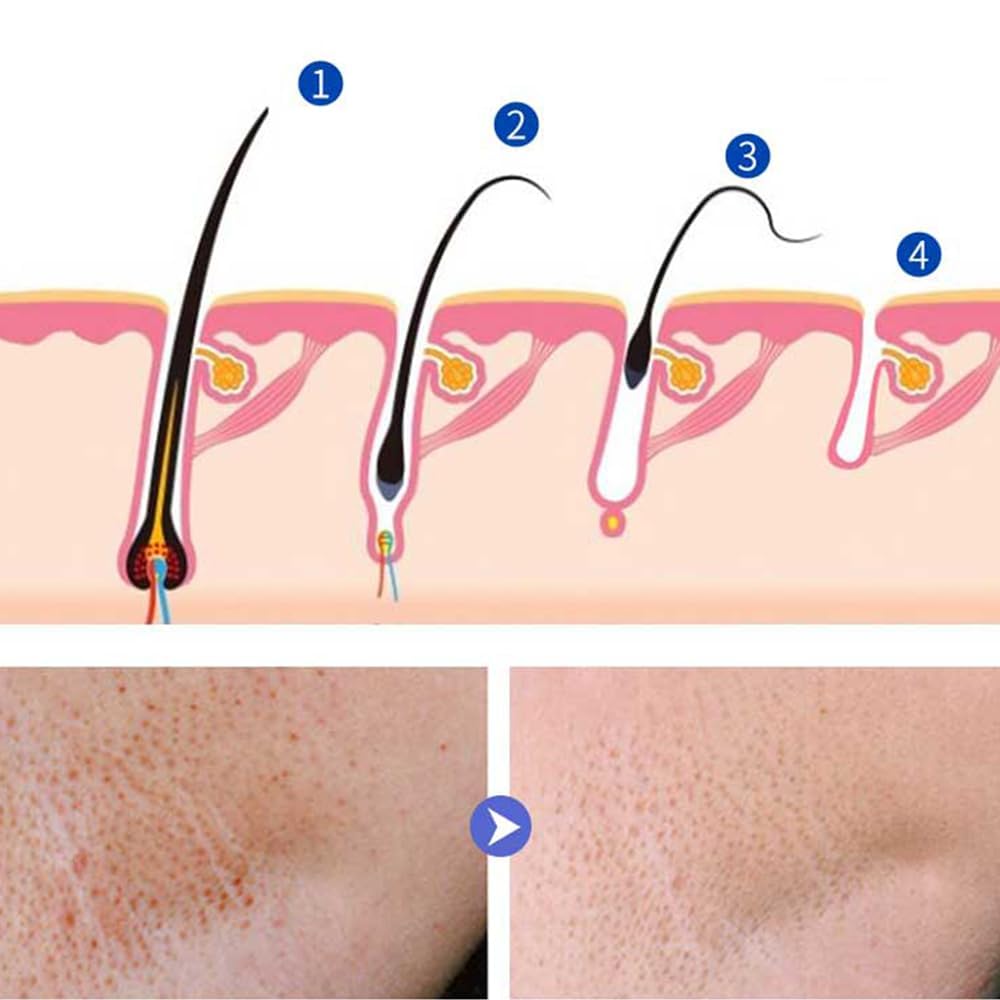 LINEDSON applied to cheek after hair removal showing calming benefit