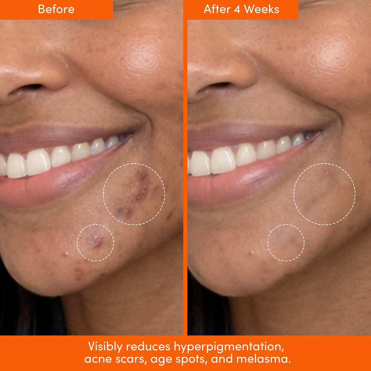 LION POSE application on face demonstrating even coverage and non-greasy finish
