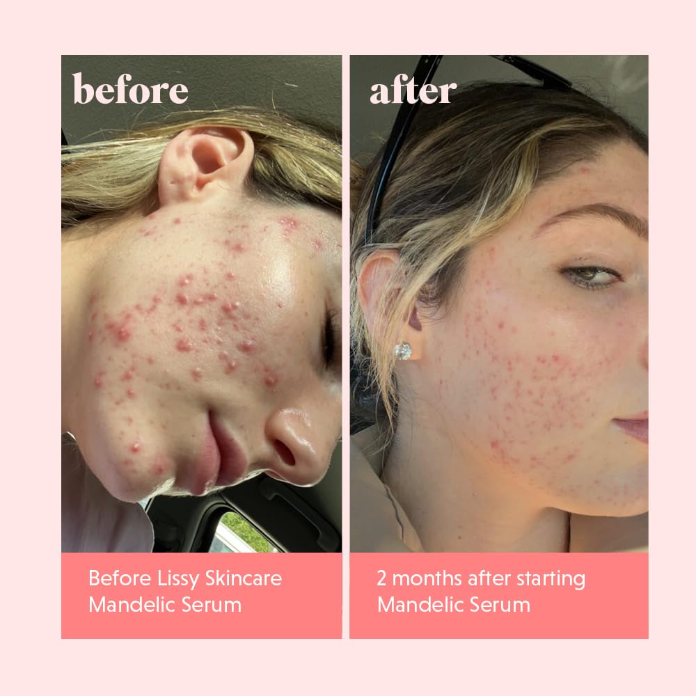 lissy skincare bottle beside sunscreen suggesting daytime protection after use