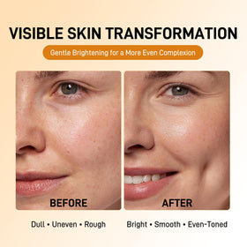 LITGIRL pad being applied to cheek demonstrating gentle exfoliation benefit
