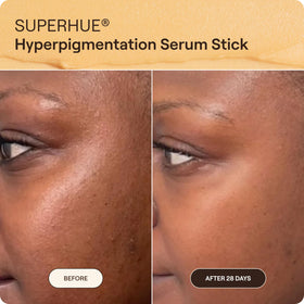 Live Tinted Superhue mini placed beside sunscreen suggesting daytime protection