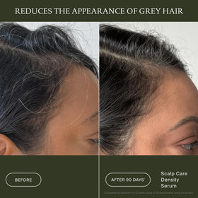 Living Proof density serum applied to scalp supports fuller hair benefit
