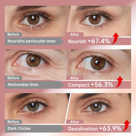 LLVYUO Novoy ingredient icons highlighting caffeine hyaluronic collagen benefits