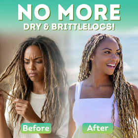 Locsanity scalp application demo with spray applied for soothing relief
