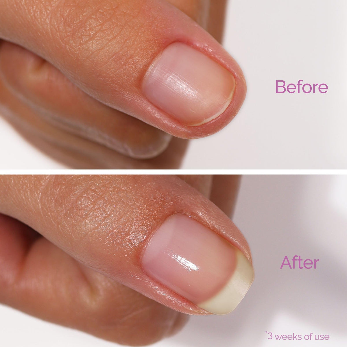 LONDONTOWN before-and-after nail comparison showing improved texture